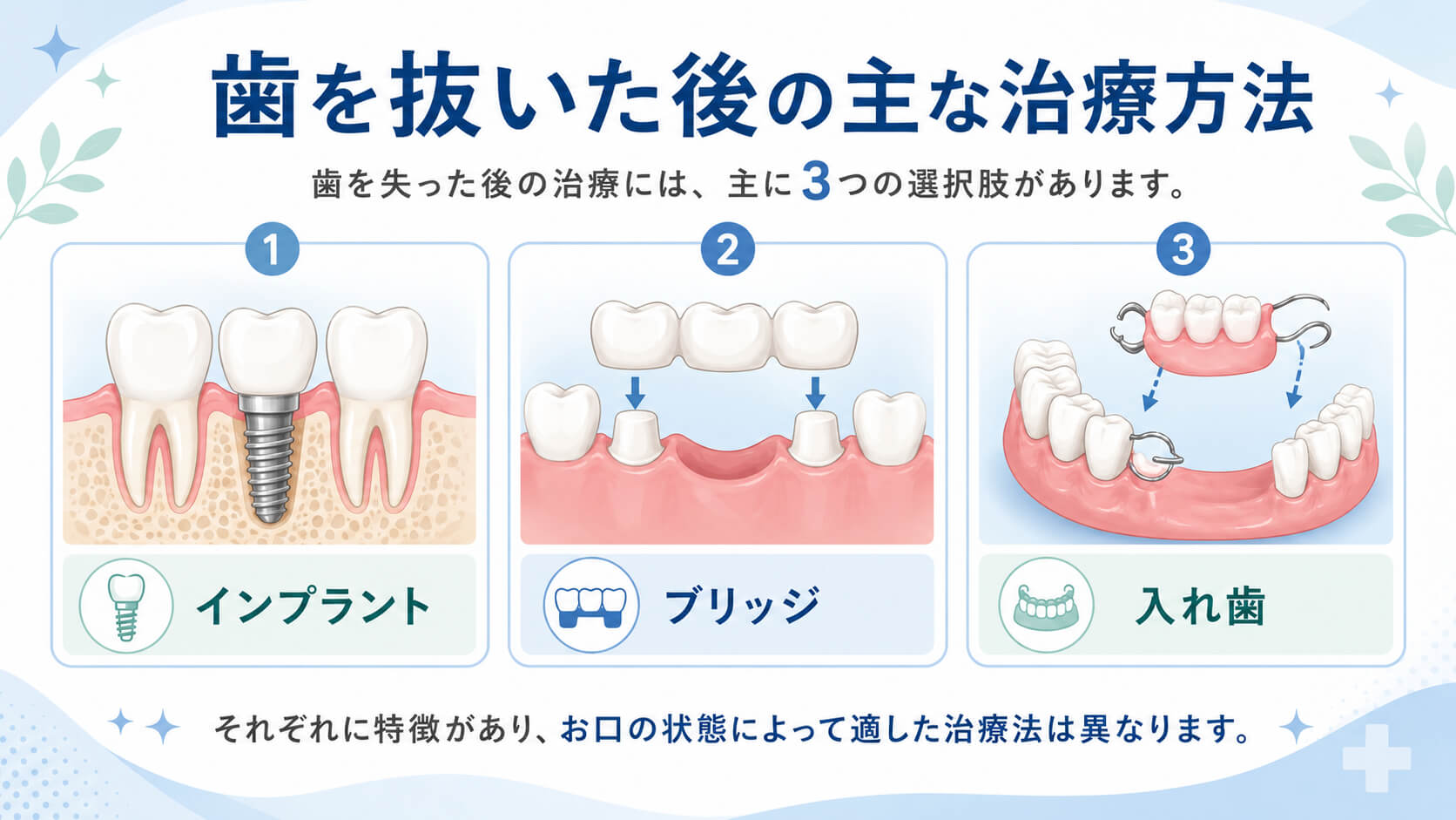 歯を抜いた後のインプラント・ブリッジ・入れ歯の比較図